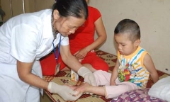 Biến chứng nguy hiểm khi mắc thuỷ đậu khiến nhiều bệnh nhân nhập viện dài ngày